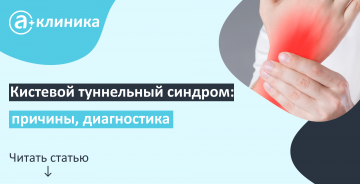 Кистевой туннельный синдром: причины, диагностика