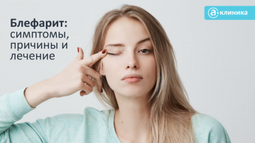 Блефарит: симптомы, причины и лечение
