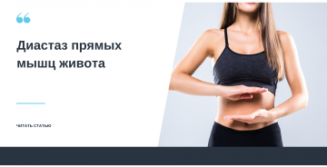 Диастаз прямых мышц живота