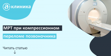 МРТ при компрессионном переломе позвоночника