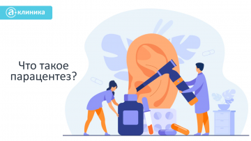 Что такое парацентез?
