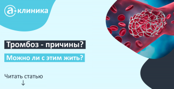 Тромбоз – причины, когда, как, и можно ли с этим жить