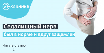 Седалищный нерв, седалищный нерв был в норме и вдруг защемлен