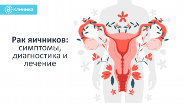 Рак яичников: симптомы, диагностика и лечение