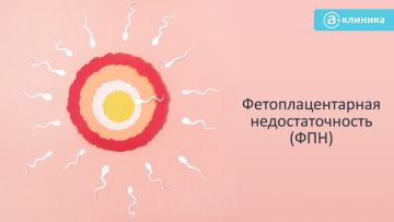 Фетоплацентарная недостаточность