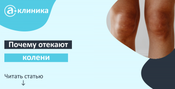 Почему отекают колени: причины, как снять отек