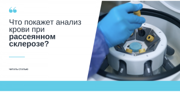 Что покажет анализ крови при рассеянном склерозе