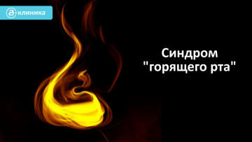 Синдром «горящего рта»
