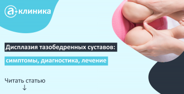 Дисплазия тазобедренных суставов: симптомы, диагностика, лечение