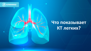 КТ лёгких: что покажет
