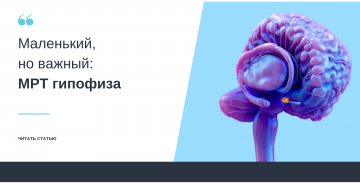Маленький, но важный: МРТ гипофиза