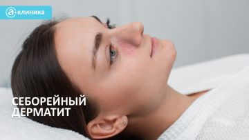 Себорейный дерматит