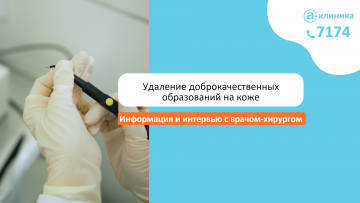Удаление доброкачественных образований на коже