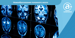 Новообразования головного мозга