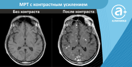 МРТ с контрастным усилением