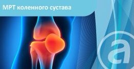 МРТ коленного сустава