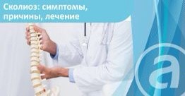 Сколиоз: симптомы, причины, лечение