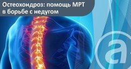 Остеохондроз: помощь МРТ в борьбе с недугом