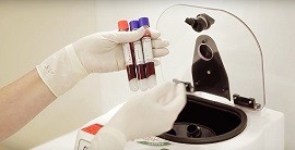 Инновационный метод лечения патологий опорно-двигательного аппарата - PRP-терапия