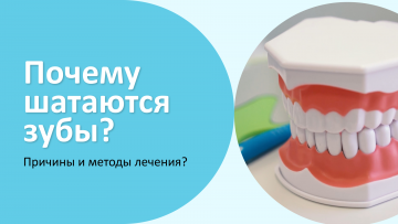 Почему шатаются зубы? Причины и методы лечения