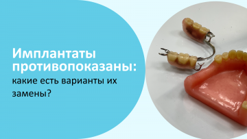 Имплантаты противопоказаны: какие есть варианты их замены?