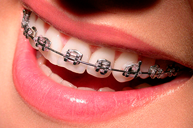 Ортодонтическая стоматология