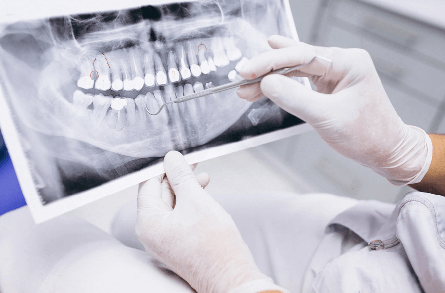 рентген зубов могилев