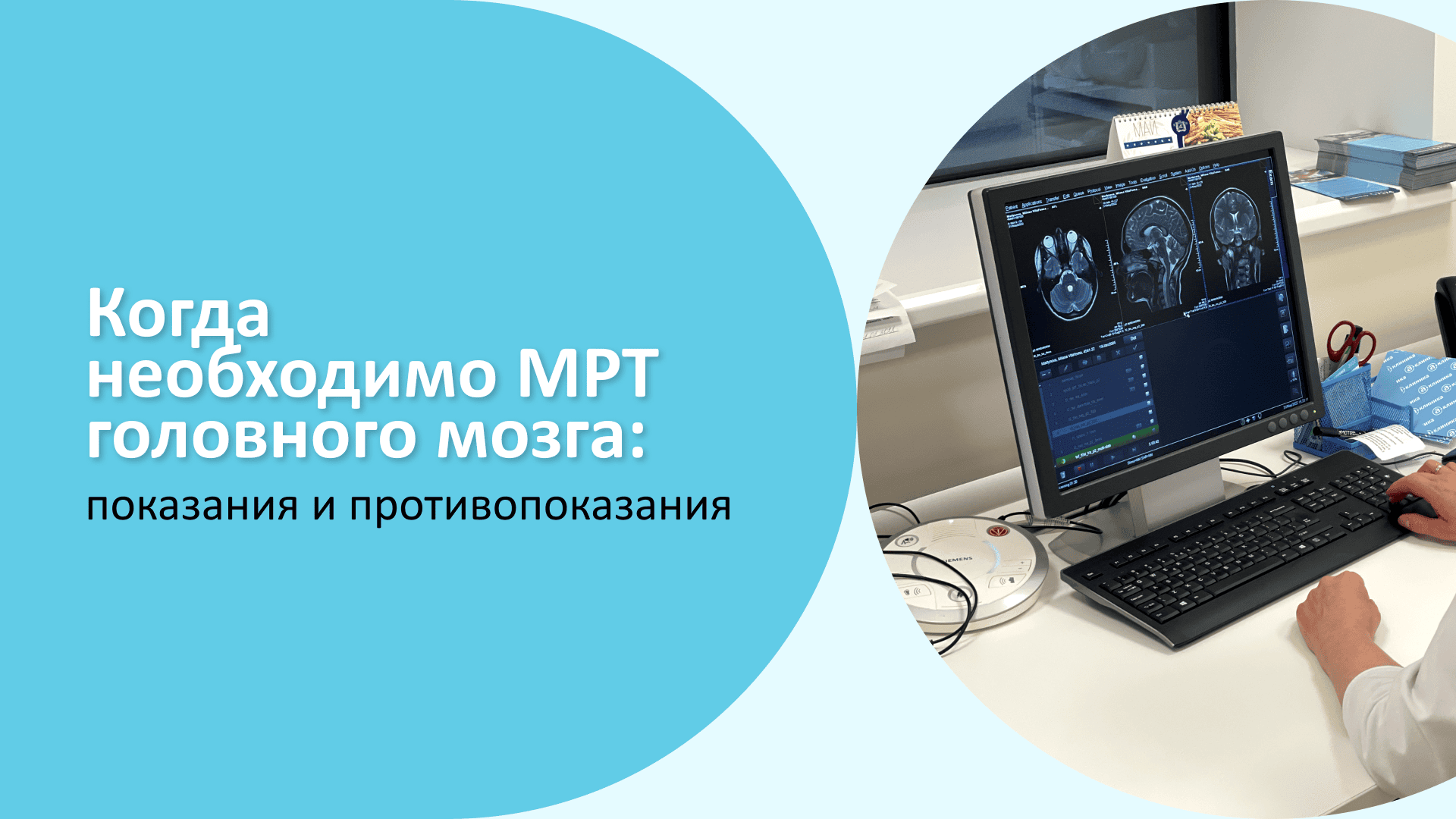 мрт головного мозга показания